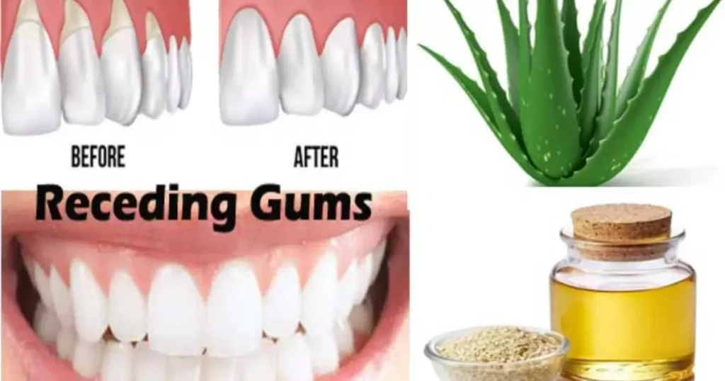 Can dentures be fitted to receding gums