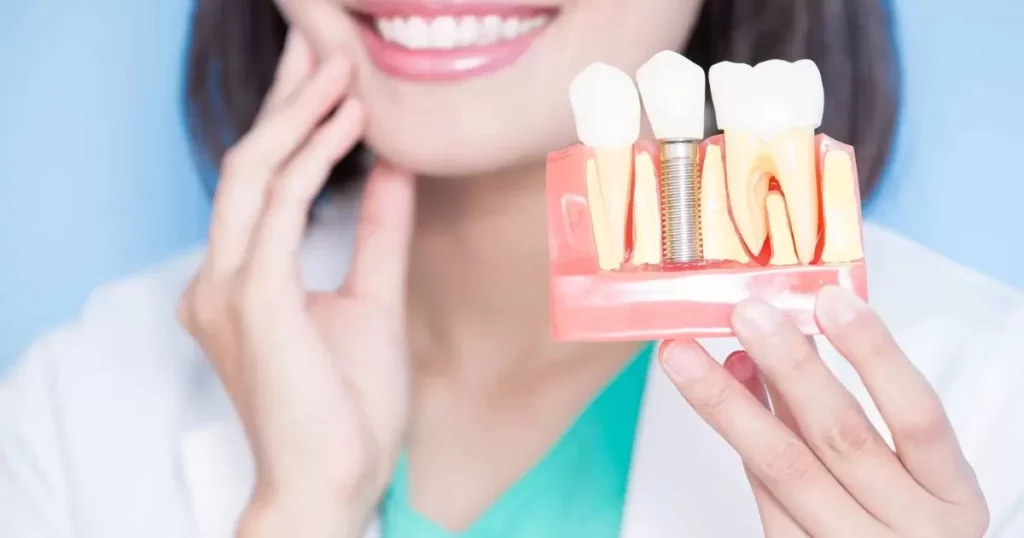 Dental Implants as Permanent Solution