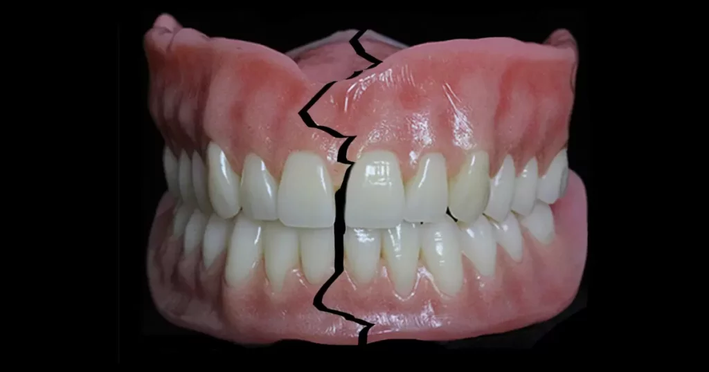 Dentures Demystified