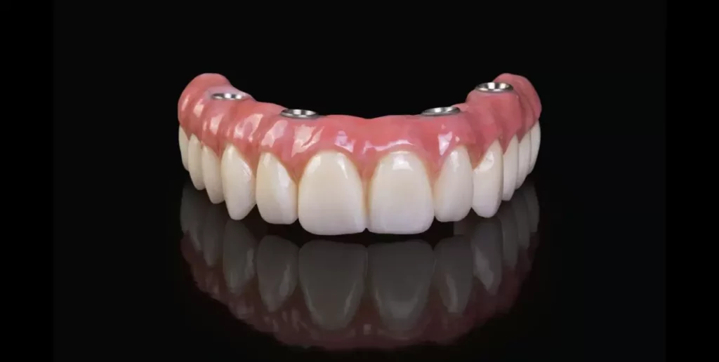 Dentures Look Like Buck Teeth