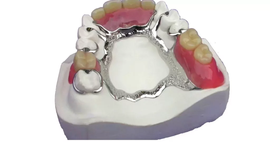 Design and Fabrication of Partial Dentures