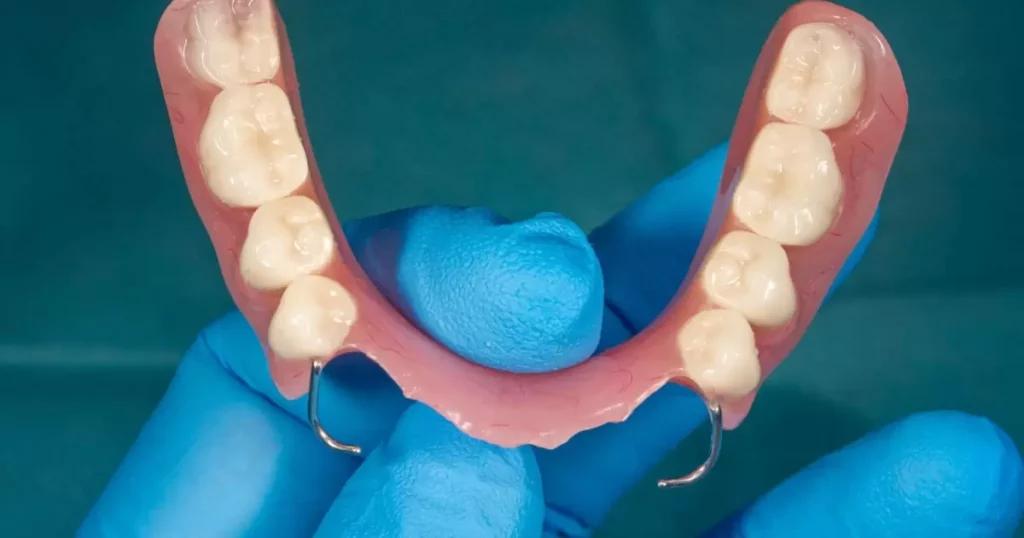 Future Developments in Partial Denture Technology