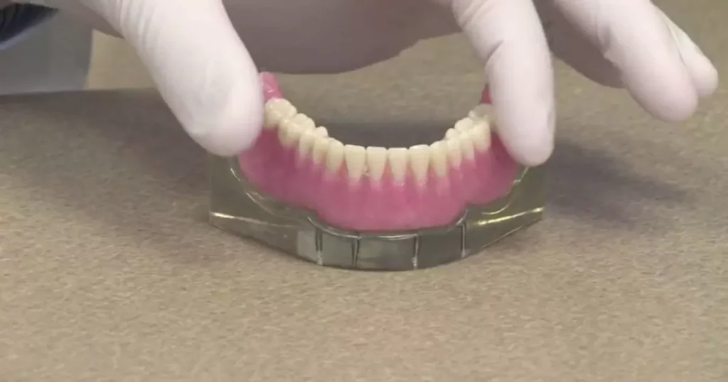 how much do snap-in denture implants cost
