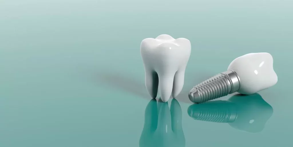 Hybrid Dental Implants Cost