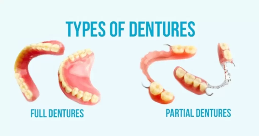 Partial dentures cost UK