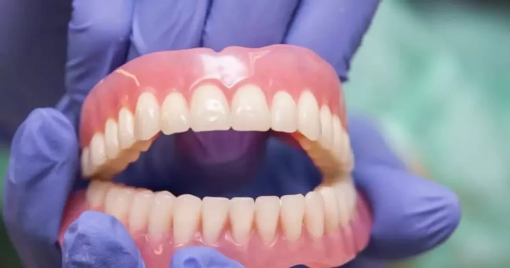 The Denture Fitting Process