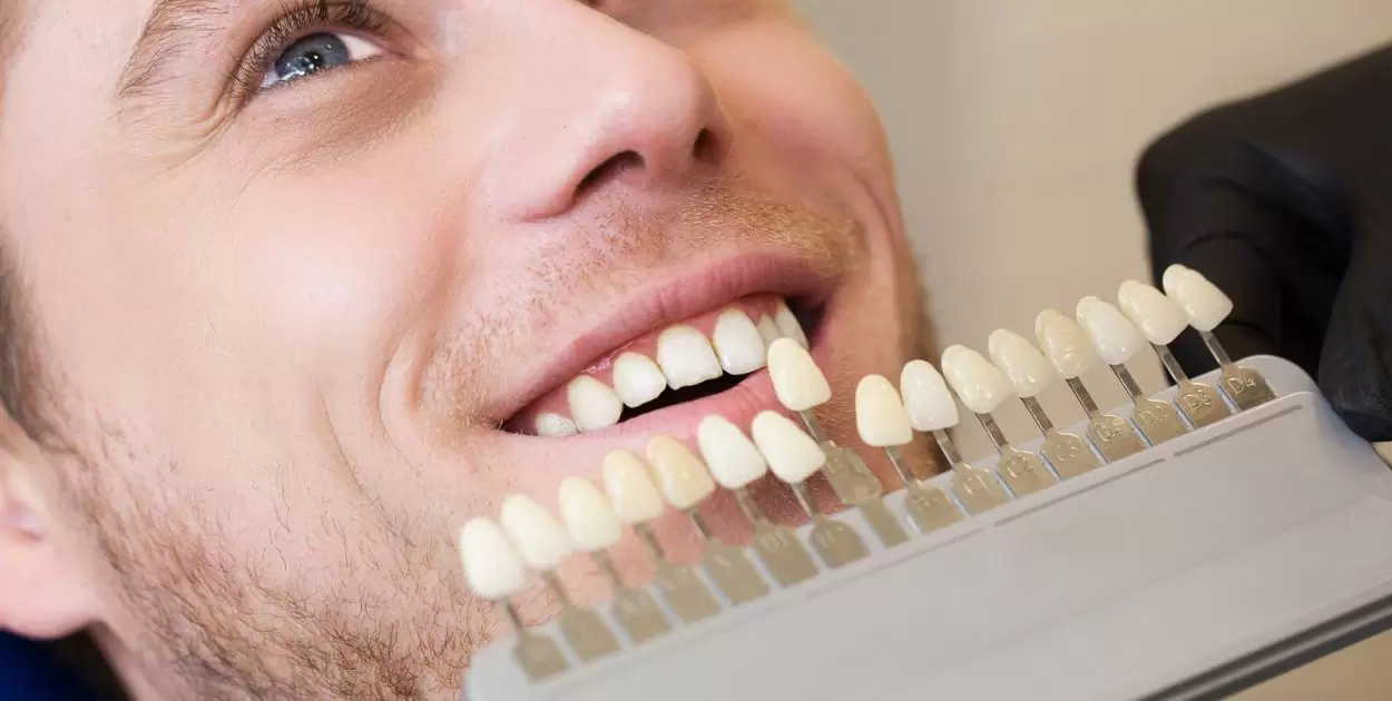 What Is The Difference Between Dentures And Veneers?