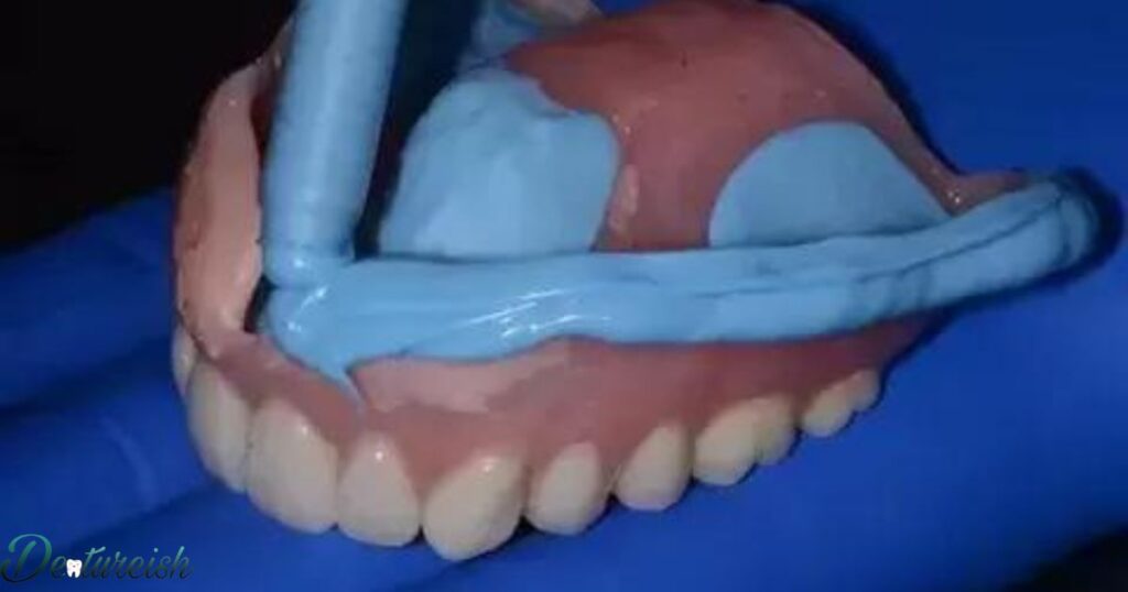 Acrylic Partial Denture Steps