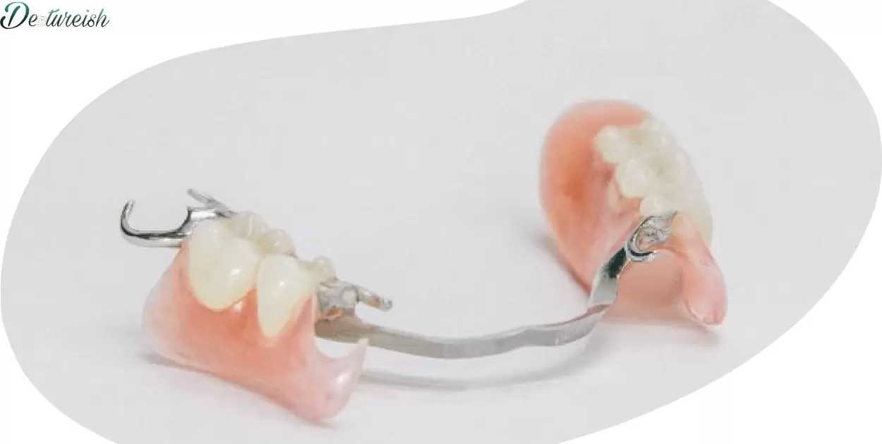 Can You Add Teeth To A Metal Partial Denture?