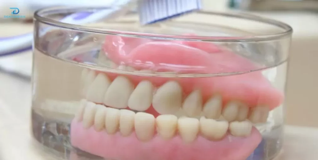 Conditions for Denture Returns