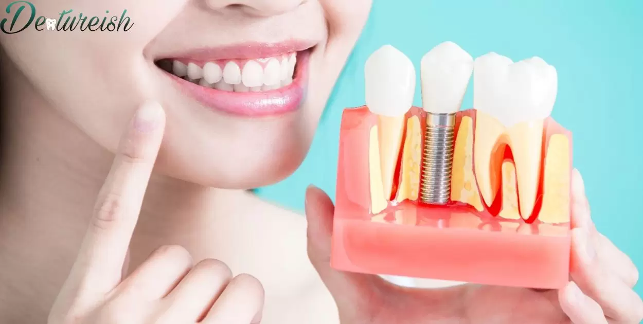 How Much Is An Implant Denture?