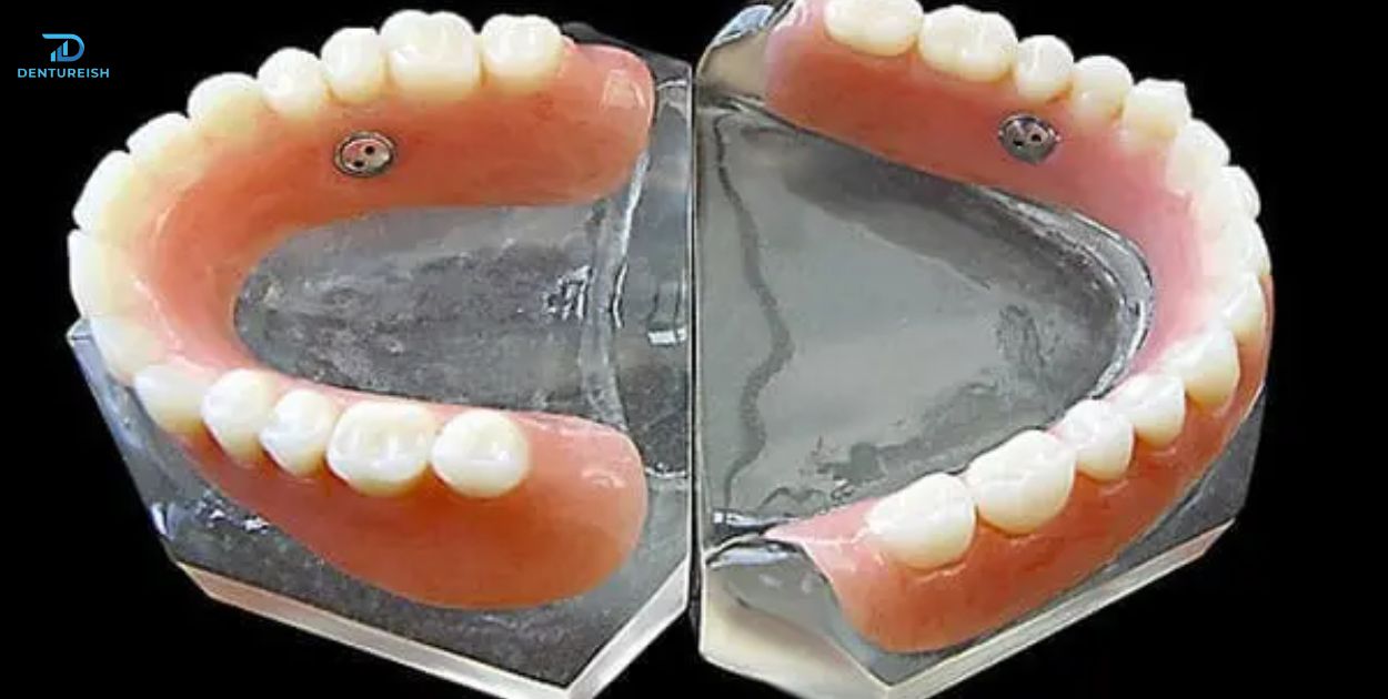 How To Make Suction Dentures?