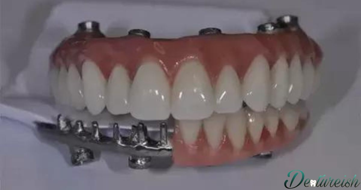 What Is A Hybrid Denture?