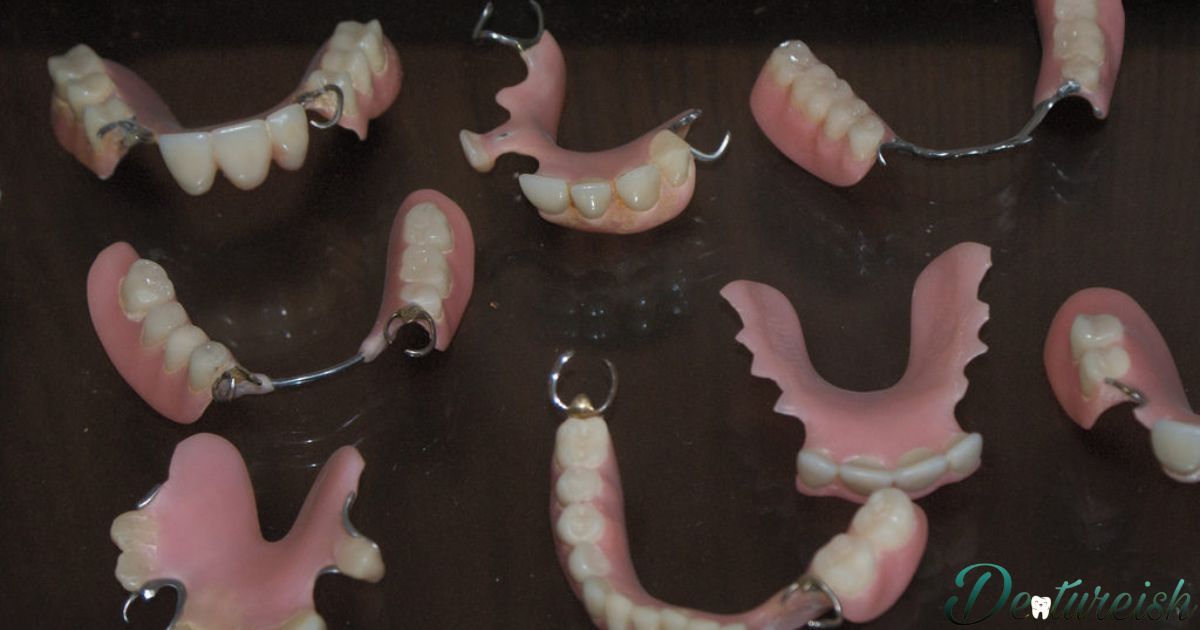 What Is An Arch In Dentures?