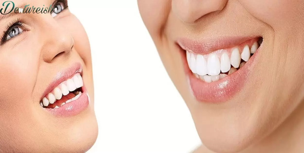 What's The Difference Between Veneers And Dentures?