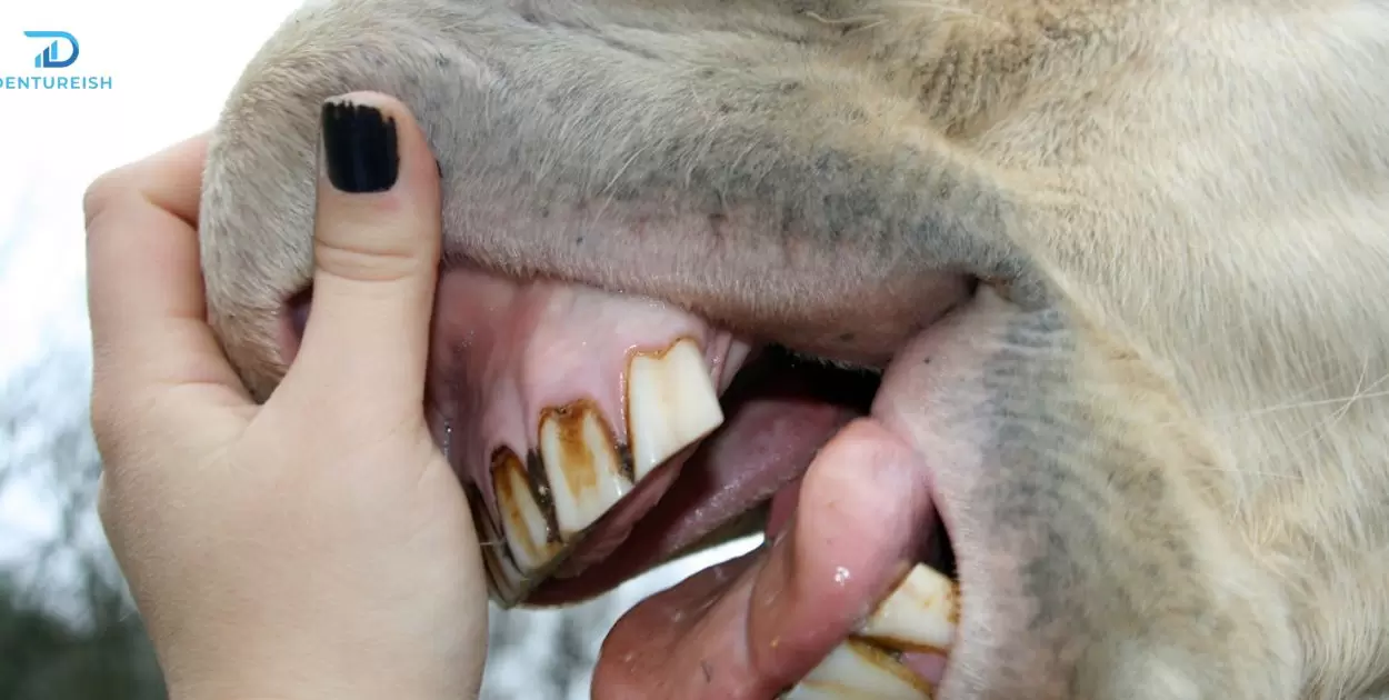 Why Do Some Dentures Look Like Horse Teeth?