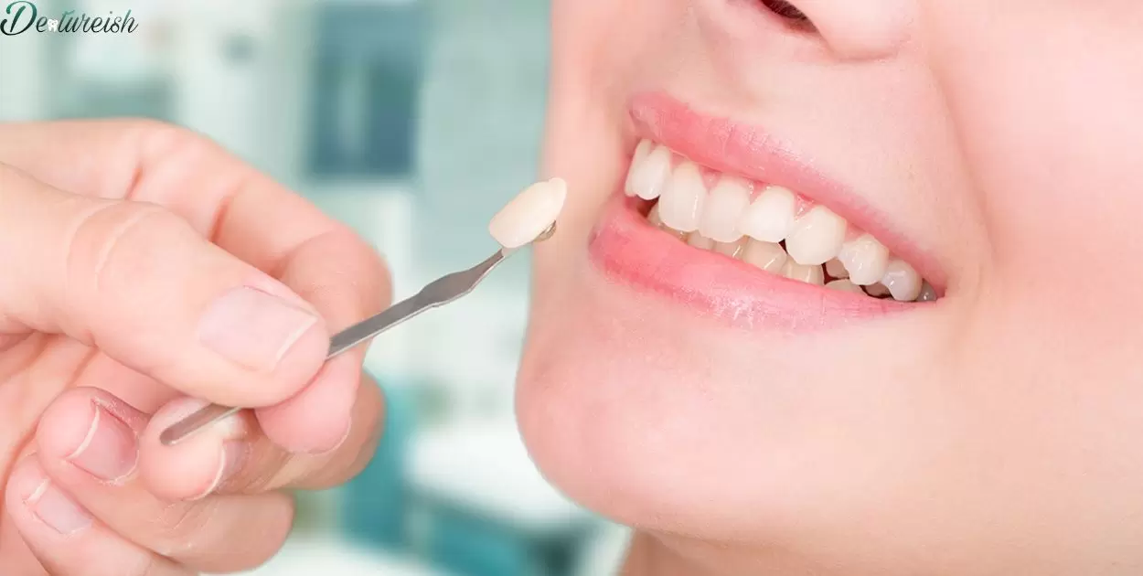 Denture Maintenance Tips for Bottom Front Teeth
