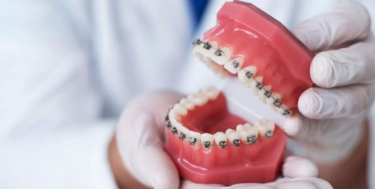 How Much Do Dentures Cost In Mexico?