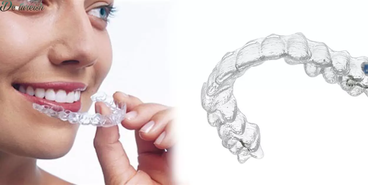 How Much Is A Replacement Retainer Invisalign