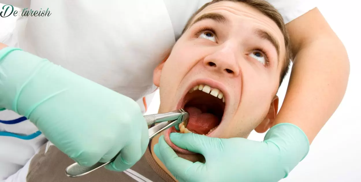 How Soon After Tooth Extraction Can I Use Poligrip?