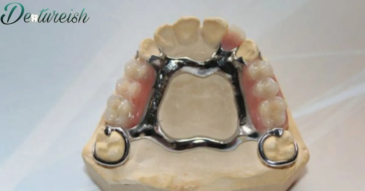 Clean Metal Partial Dentures