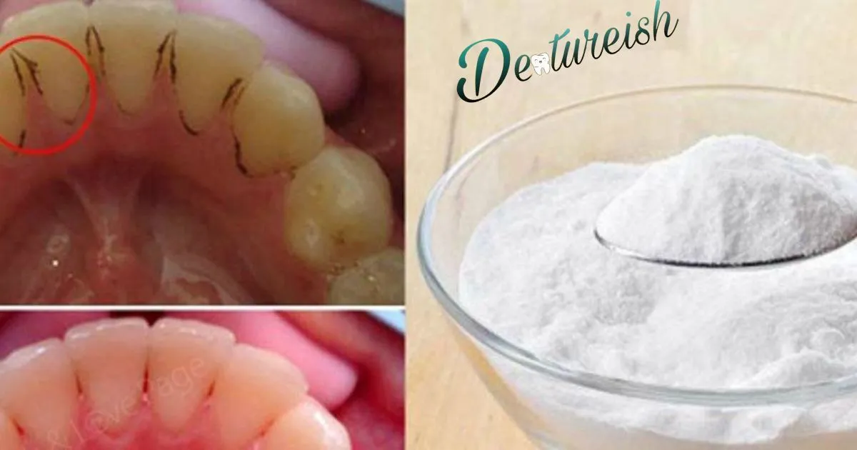 How To Clean Plaque Off Dentures? Dentureish