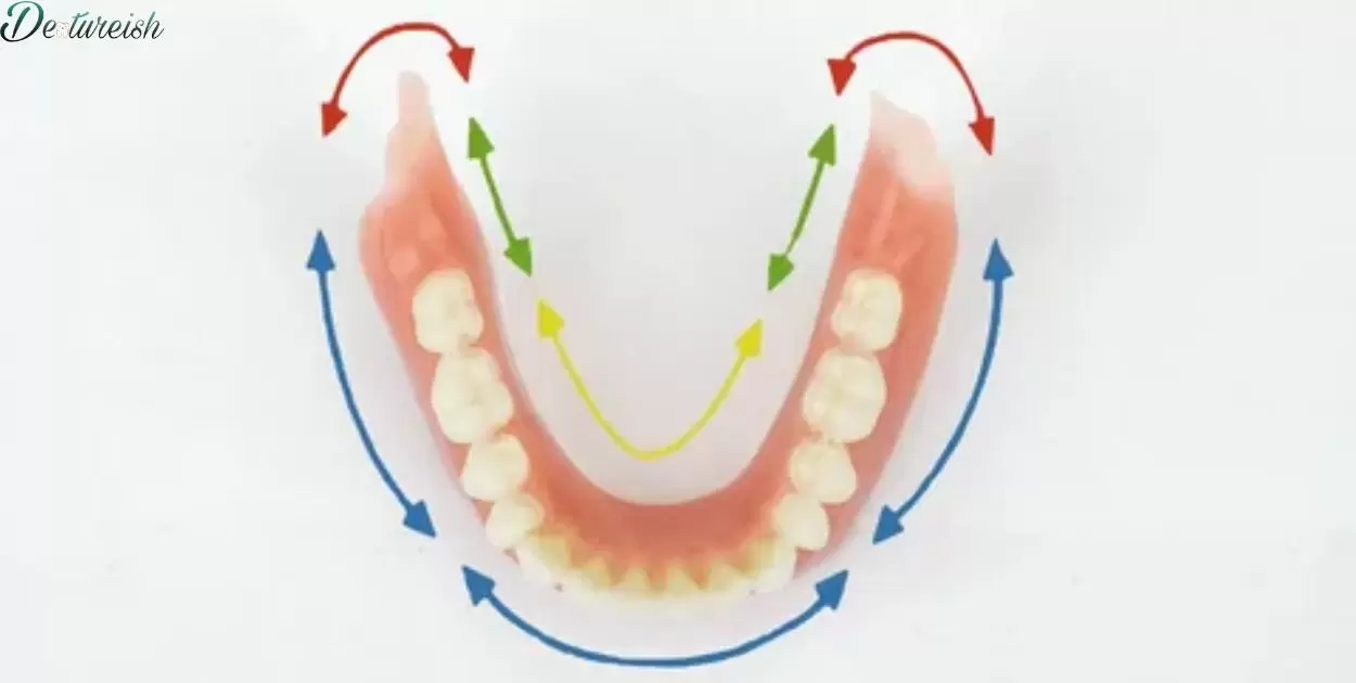 Lower Partial Dentures Bottom Front Teeth?