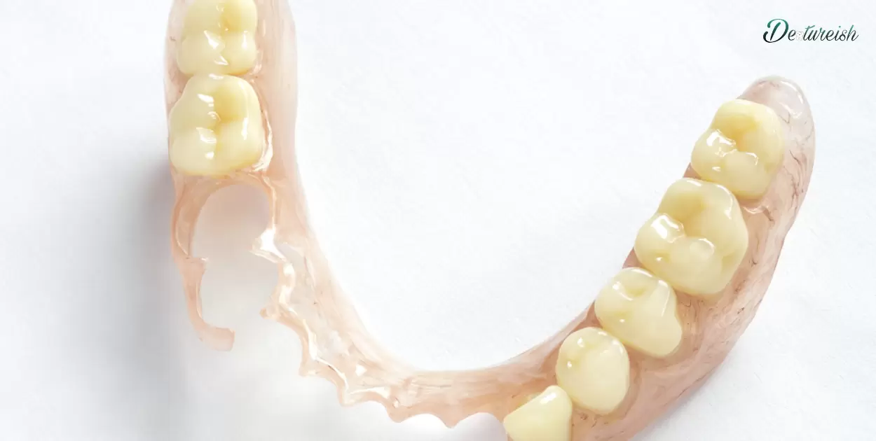 upper partial dentures for back teeth?