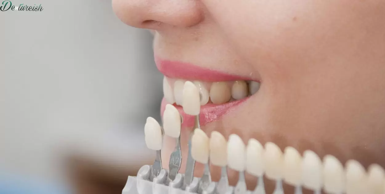 What's The Difference Between Dentures And Veneers?