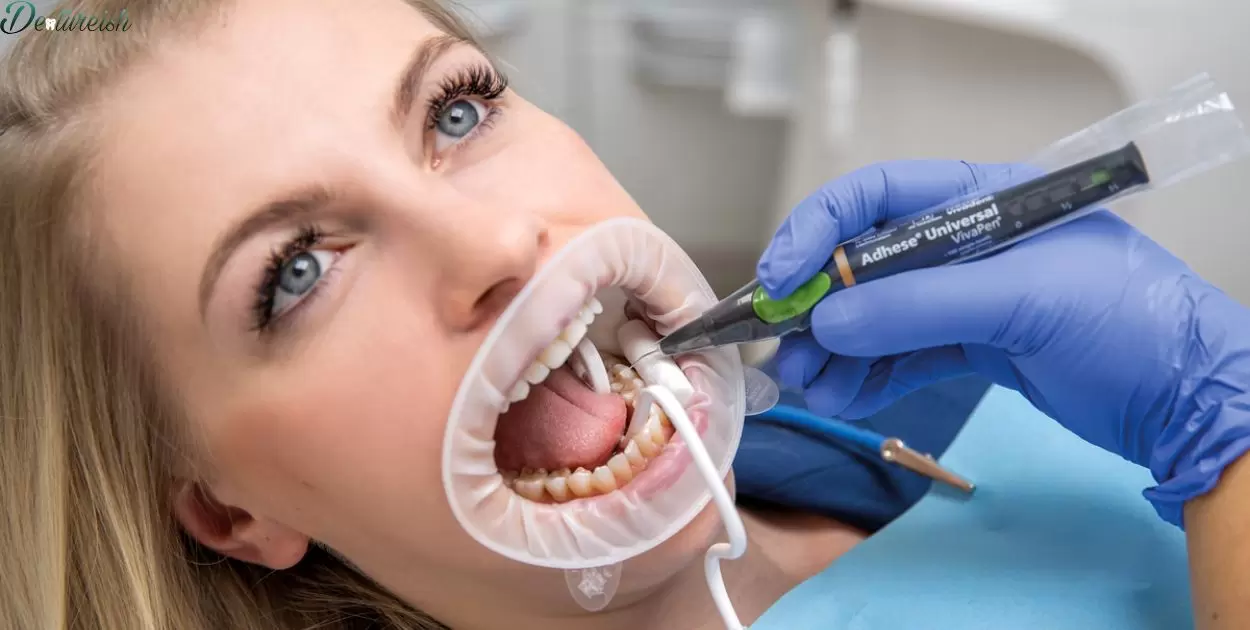When to Consider Dental Adhesives and Dissolving Agents