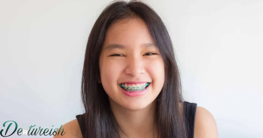 Braces Key Questions To Ask The Orthodontist
