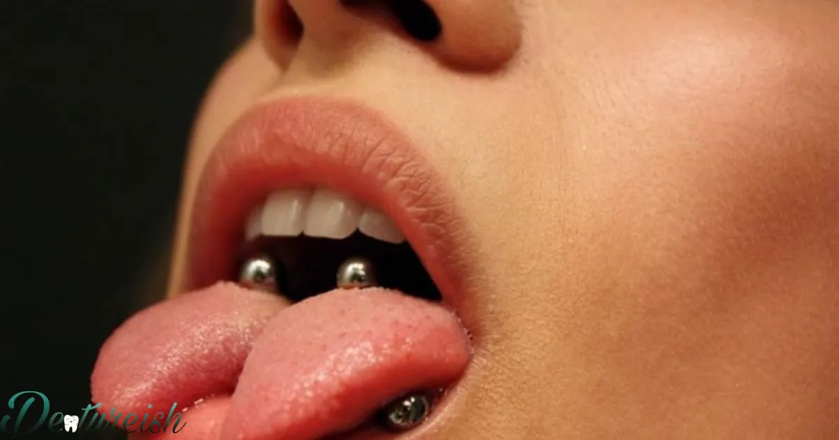 Can You Get Braces With A Tongue Piercing?