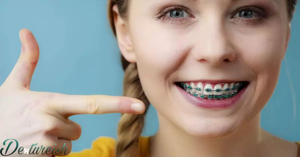 Do Teal Braces Stain