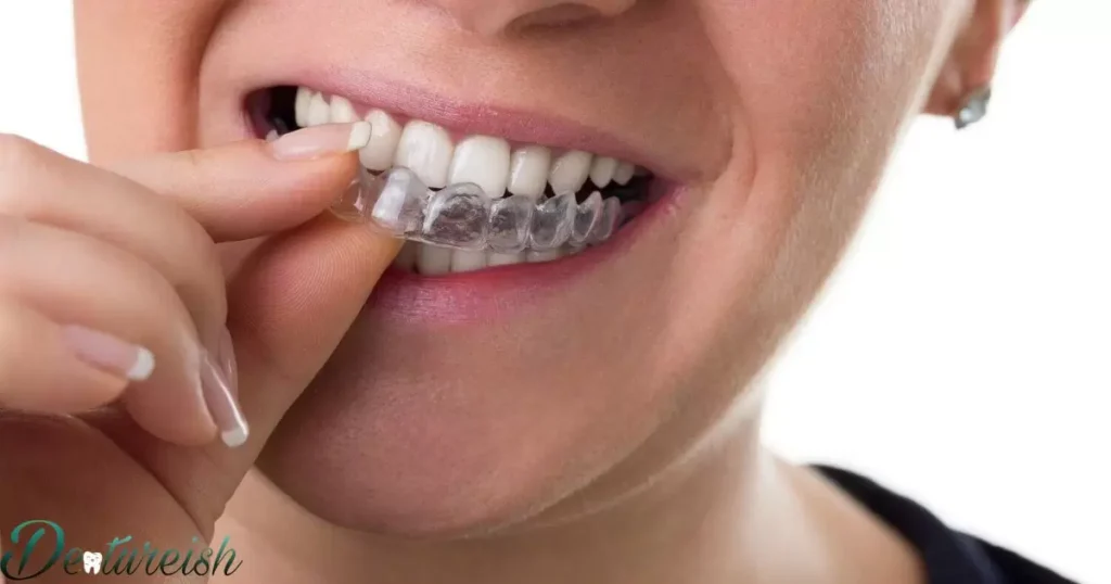 How Braces Work To Straighten Teeth 