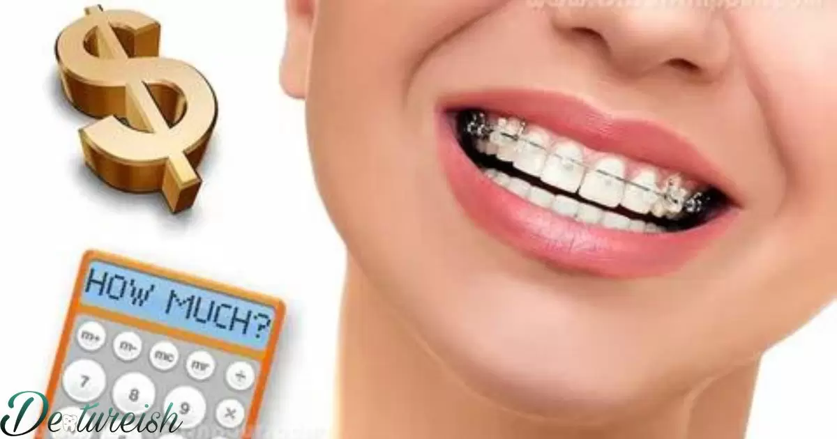 How Much Do Braces Cost Michigan?