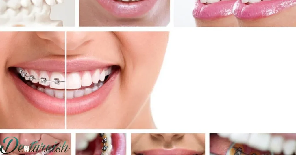 Are There Braces Hidden Behind Your Teeth?