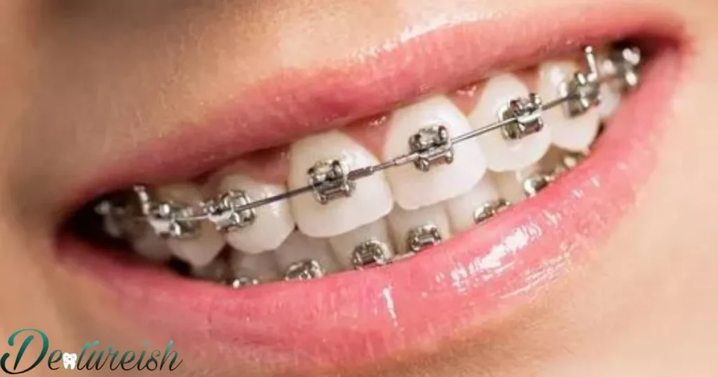 Braces In Other Contexts