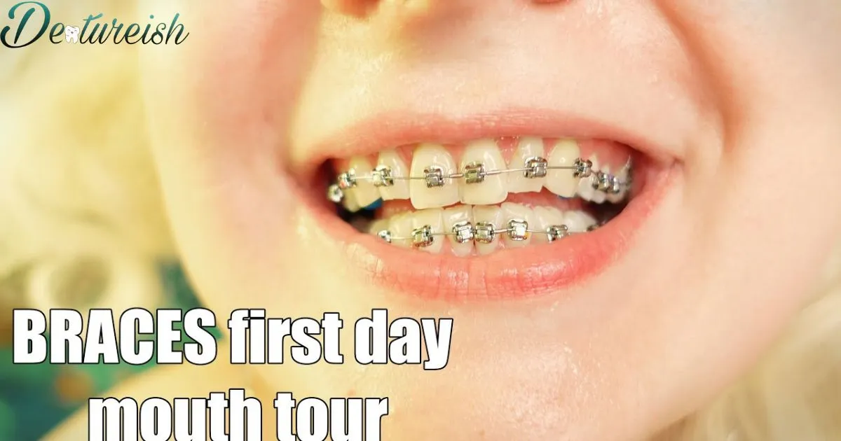 Can I Eat Chicken With Braces On The First Day?