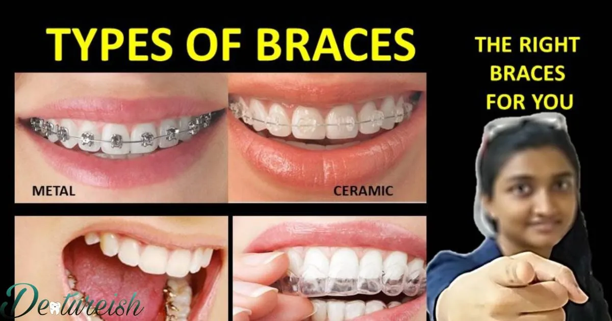 Different Types Of Braces For Adults