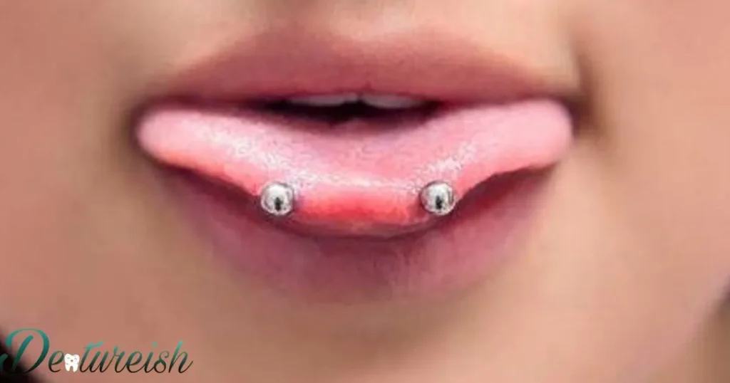 What Are The Braces Key Considerations For Tongue Piercing?