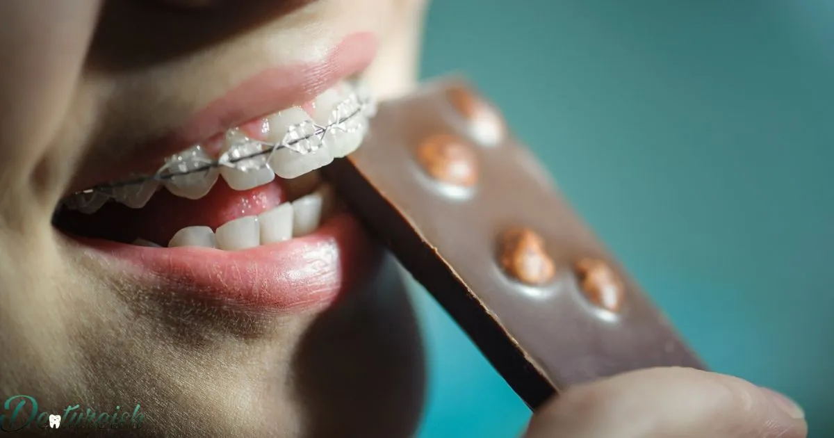 What Candies Can You Eat With Braces?