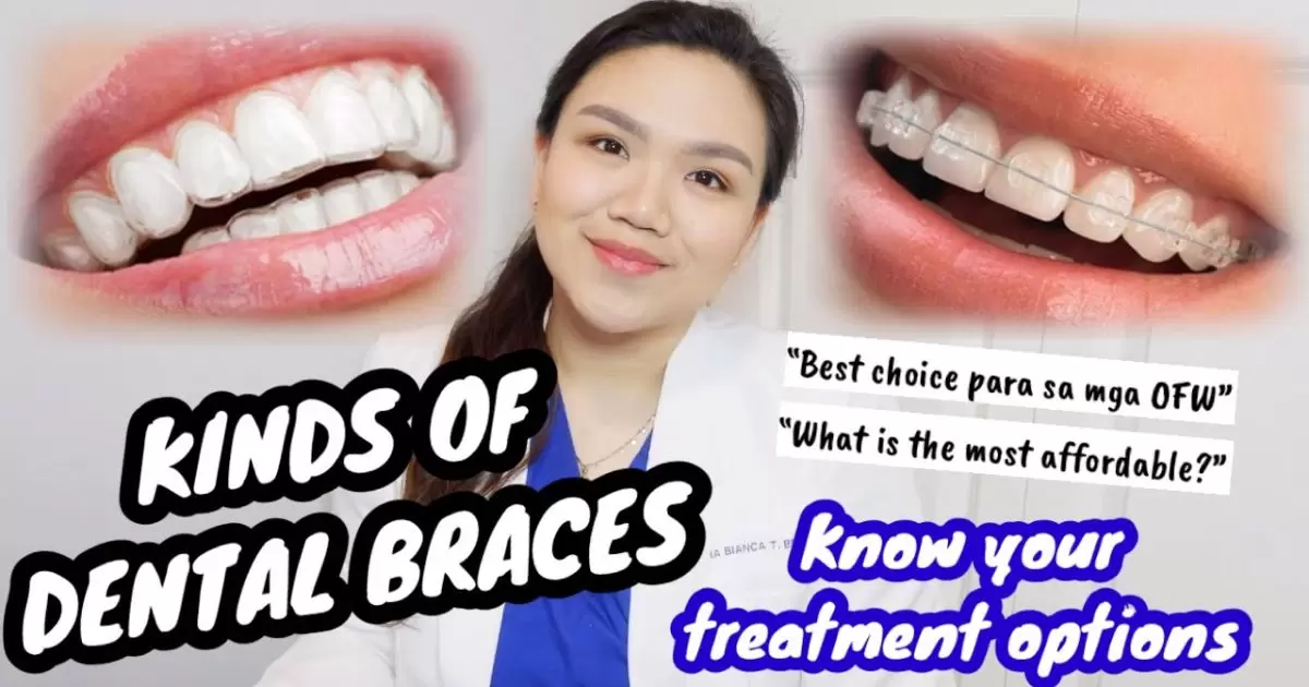 What Kinds Of Braces Are There?
