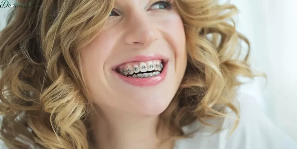 What Other Types Of Braces Exist Beyond Teeth?